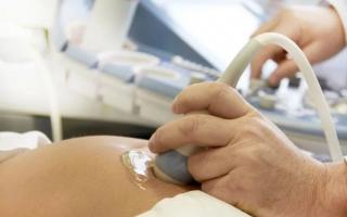 Умеренное маловодие при беременности: причины и последствия, диагностика и лечение Острое маловодие